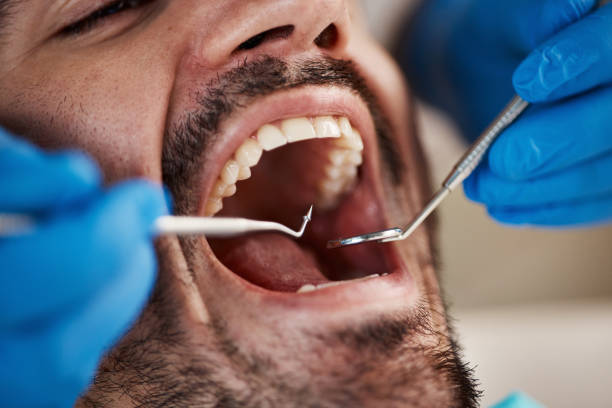 Best Emergency Treatment for Oral Infections in Bull Mountain, OR