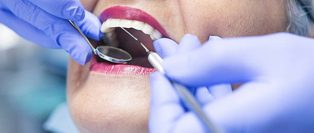 Best Emergency Wisdom Tooth Extraction in Bull Mountain, OR